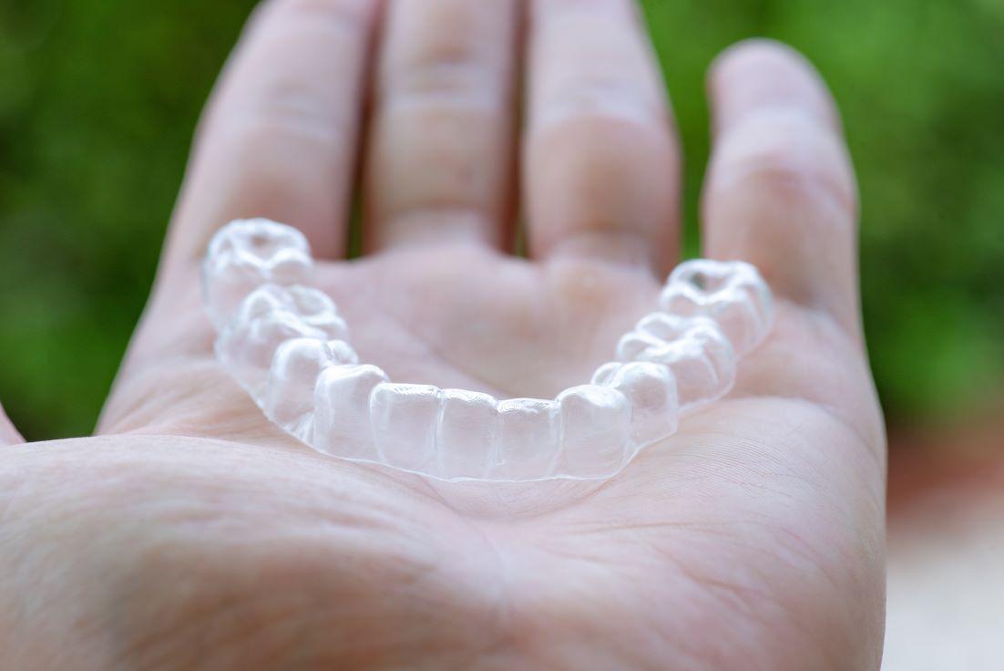 Not Wearing Your Aligners?